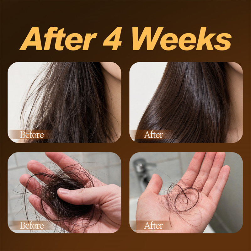 SEVICH Siyah Şampuan Bar 120g  - Hair Care Pantene incelemesi ve fiyatı