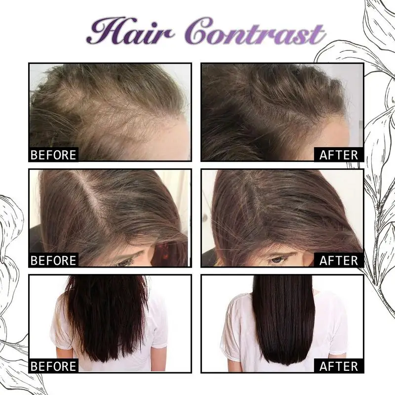 30ml Soğan Biberiye Saç Dökülm - Hair Care Ordinary incelemesi ve fiyatı