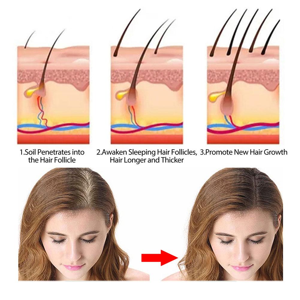 Biberiye Şampuan Sabunu Zencef - Hair Care Pantene incelemesi ve fiyatı