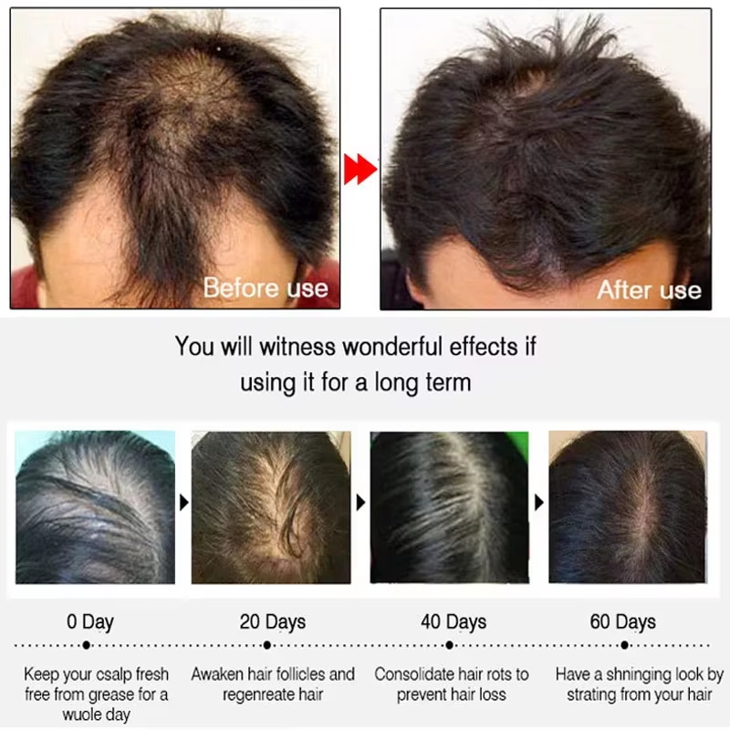 Hızlı Zencefilli Saç Uzatma Sp - Hair Care Natural incelemesi ve fiyatı
